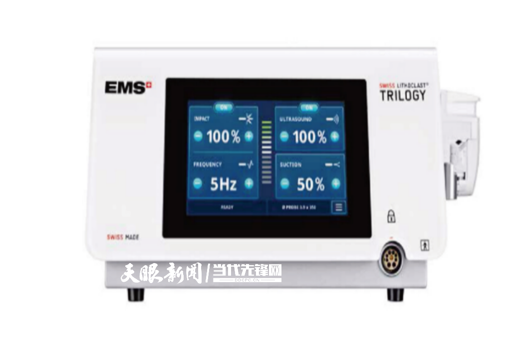 泌尿系统结石患者福音：贵州有了最新一代微创“碎石机”(图1)