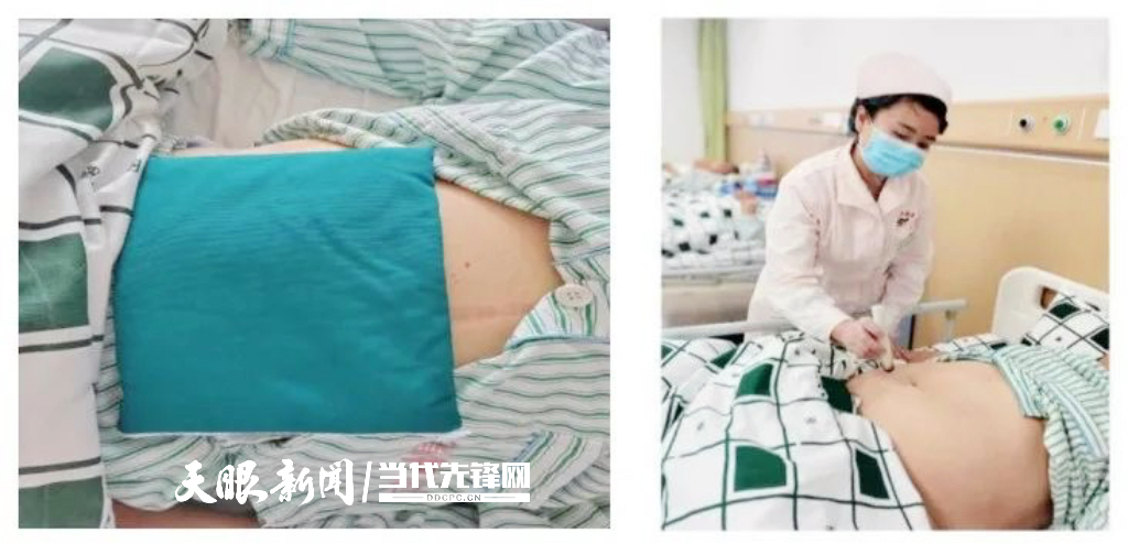 泌尿系统结石患者福音：贵州有了最新一代微创“碎石机”(图2)