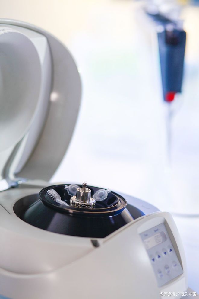 Kaiyun体育网站：全球与中国转子离心破碎机市场发展趋势及投资价值研究报告(图1)