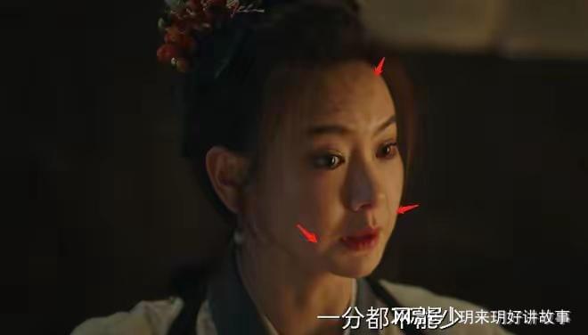 戚薇自曝医美过度险毁容！268亿围观背后她这波操作比甄嬛还绝(图7)